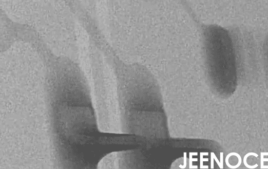 xray检测设备.png