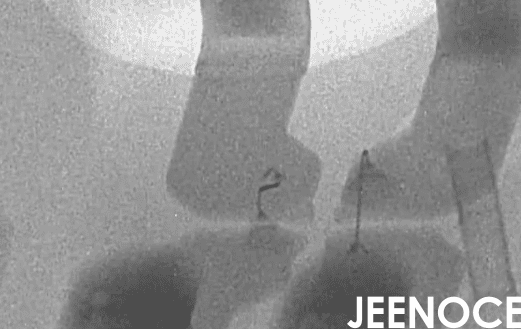 xray检测设备.png