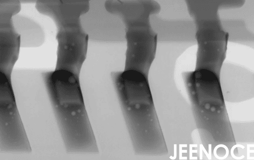 X-ray.png