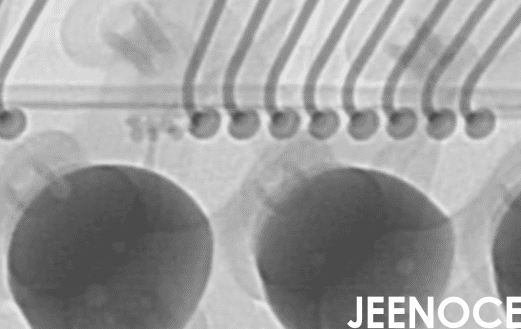X-ray.png