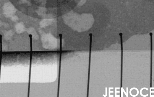 X-ray.png