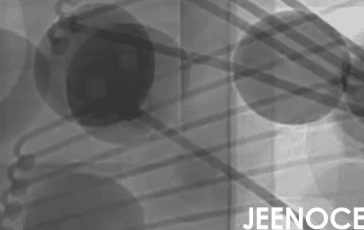 xray设备.png