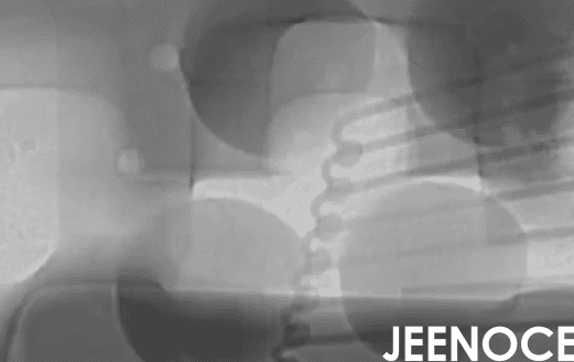 xray检测设备.png