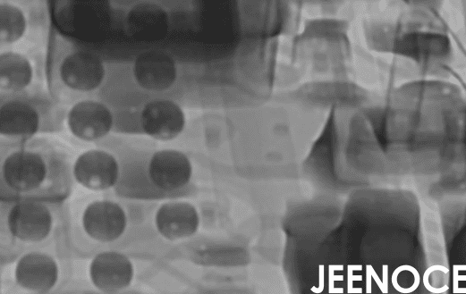 X-ray.png