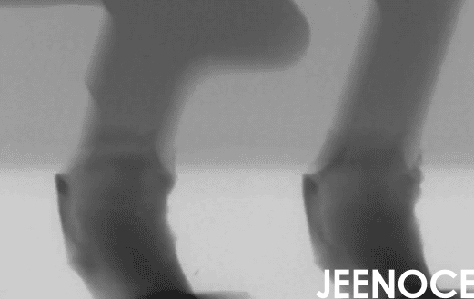 X-ray.png