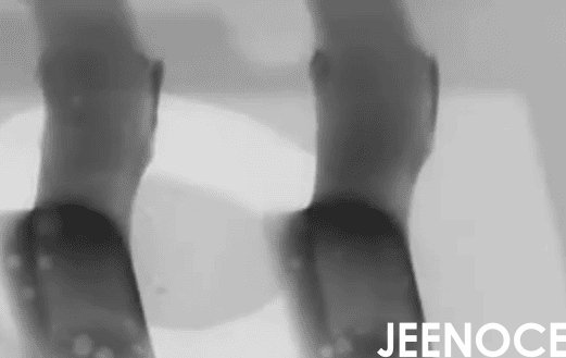 X射线设备.png X射线设备.png