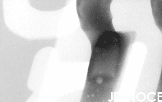 X-ray.png
