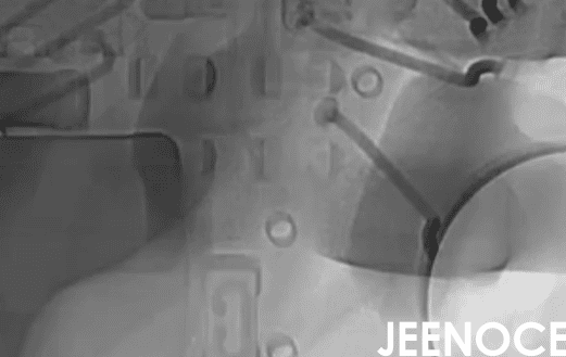 3D X-Ray 检测：Chiplet 先进封装不可或缺的质量防线(图1)