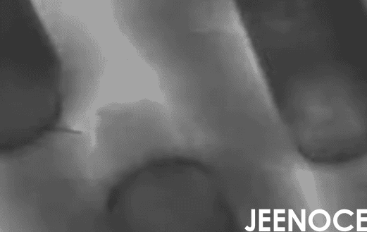 X-ray.png