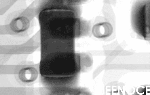X-ray.png