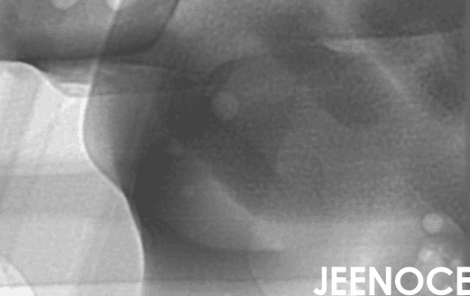 xray检测设备.png