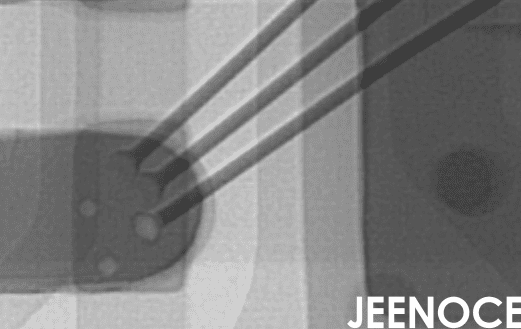 X-ray.png X-ray.png