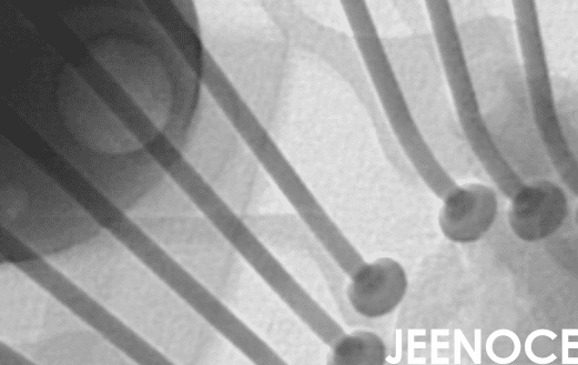 xray检测设备.png
