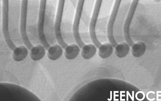 X-ray.png X-ray.png