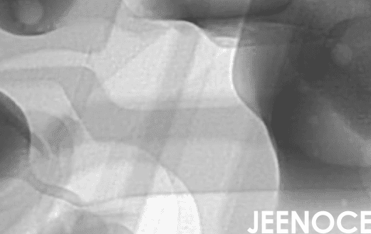 X-ray.png X-ray.png