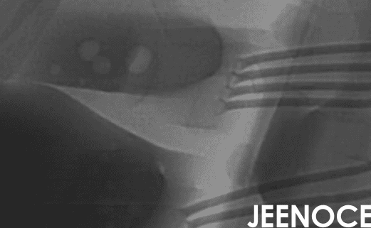 xray检测设备.png