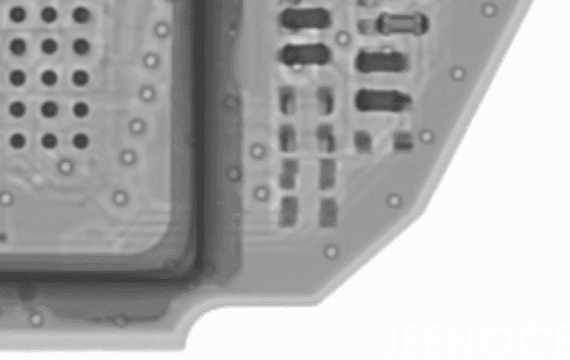X-ray.png