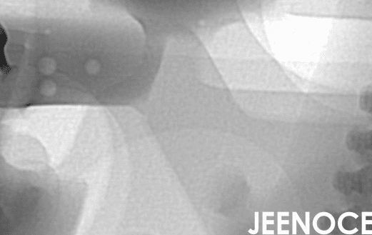 xray检测设备.png xray检测设备.png