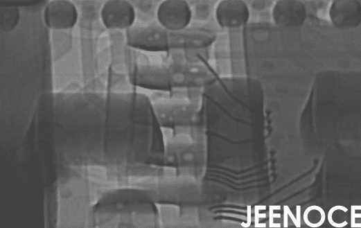 x-ray设备.png x-ray设备.png