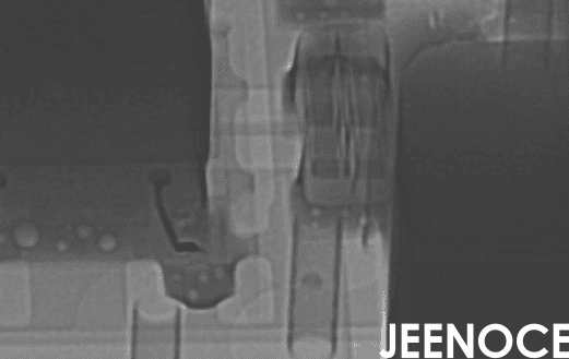 X-ray.png