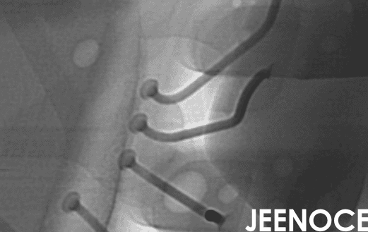 X-ray.png