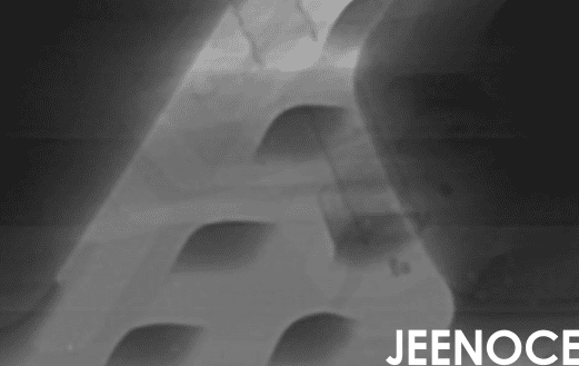 xray设备.png